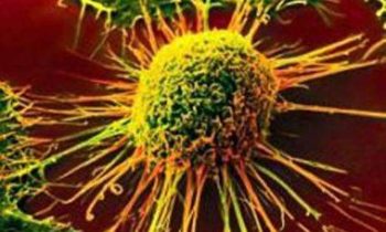 Fighting cancer with the help of someone else’s immune cells